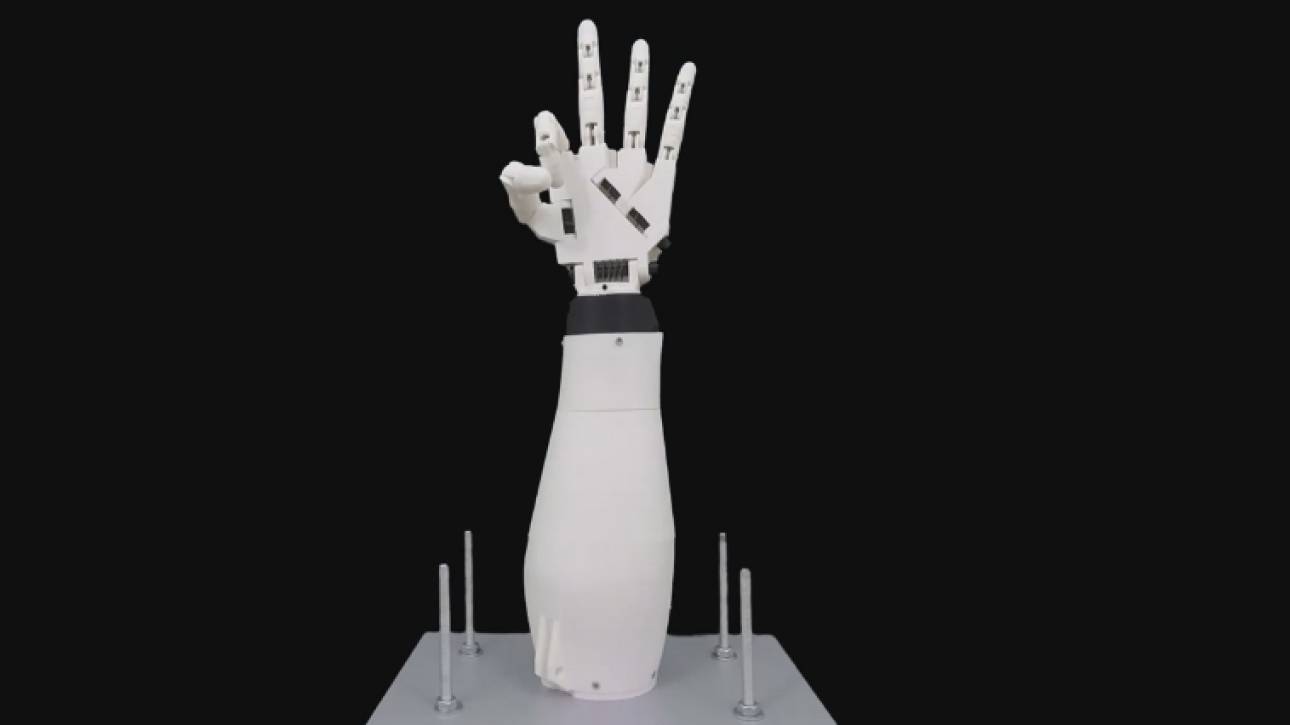 Μαθητής γυμνασίου κατασκεύασε ρομποτικό χέρι