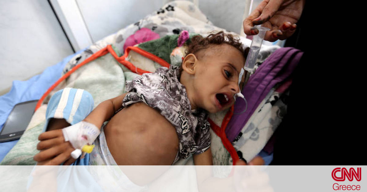 Αποτέλεσμα εικόνας για Υεμένη : Η χειρότερη ανθρωπιστική κρίση των τελευταίων ετών