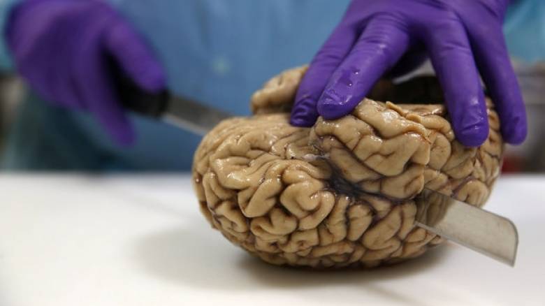 Νέα έρευνα συνδέει τους εγκεφαλικούς όγκους με την ακαδημαϊκή εκπαίδευση