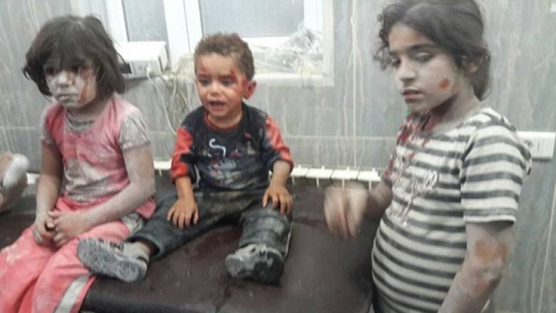 Χαλέπι: Ματωμένο παιδί δεν φεύγει από την αγκαλιά του νοσοκόμου του