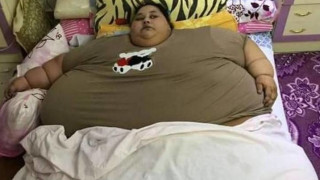 Γυναίκα 500 κιλών μπαίνει στο χειρουργείο για να χάσει κιλά