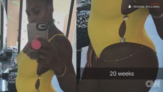 Η Σερένα Γουίλιαμς αποκάλυψε την εγκυμοσύνη της με μία selfie