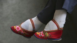 Τα «πόδια του λωτού»: ο πραγματικός λόγος που οι Κινέζες έδεναν τα πόδια τους