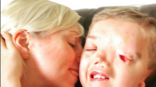 Το Instagram κατέβασε φωτογραφία αγοριού χωρίς μάτι, για διάκριση κάνει λόγο η μητέρα