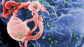 Harvard & MIT: Με επαναστατικό σούπερ-αντίσωμα στον πόλεμο κατά του HIV