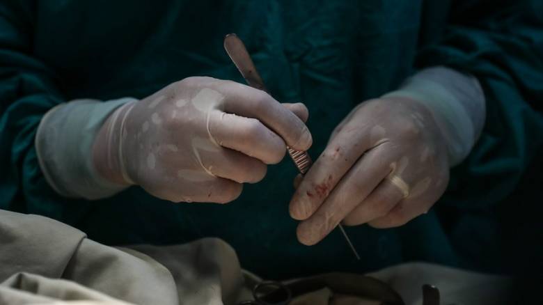 Βρετανία: Χειρουργός «υπέγραψε» με τα αρχικά του στα συκώτια δύο ασθενών