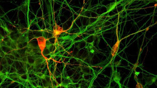 ΗΠΑ: Επιστήμονες ανακαλύπτουν νέα μέθοδο δημιουργίας νευρώνων από ανθρώπινα κύτταρα