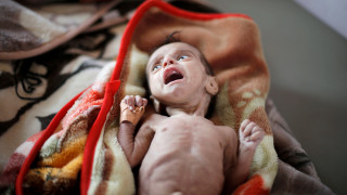 SOS από Υεμένη: Πάνω από 5 εκατομμύρια παιδιά στα όρια του λιμού