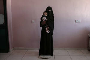 Η Ουμ Μιζρά, μια 25χρονη γυναίκα από την Υεμένη, κρατάει το γιο της σε μια ζυγαριά στο νοσοκομείο του Άντεν.  Το παιδί, 17 μηνών, ζυγίζει 5,8 κιλά, το μισό του φυσιολογικού βάρους για την ηλικία του.