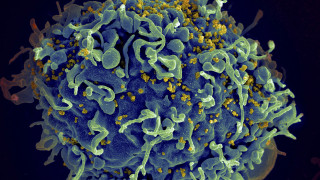 Το τέλος του AIDS πλησιάζει: Επαναστατική θεραπεία εμποδίζει τη μετάδοση του HIV