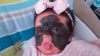 Μωρό – «Mπάτμαν»: Μόλις τεσσάρων μηνών και θύμα ασύλληπτου ρατσισμού