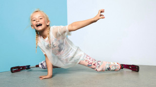 Το πραγματικό Next Top Model: Μια 9χρονη χωρίς πόδια κατακτά τις πασαρέλες