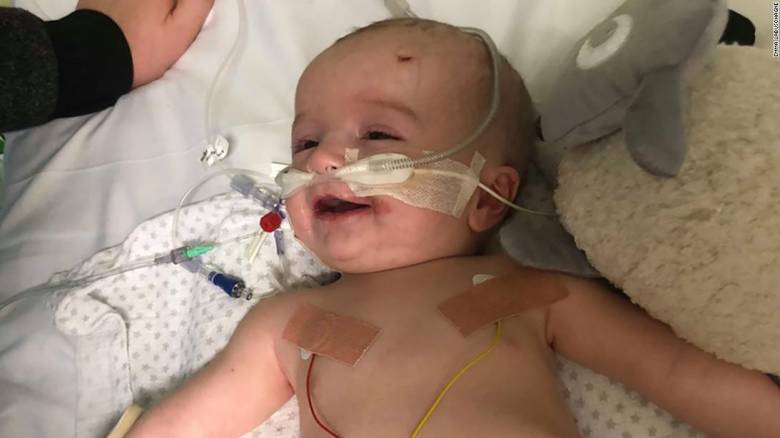 Ξύπνησε από κώμα και χαμογέλασε: Συγκινεί η περίπτωση μωρού 14 μηνών που παλεύει για τη ζωή του