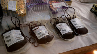 Απευθείας στα νοσοκομεία η προμήθεια των παραγώγων αίματος – Μητρώο ασθενών για γ-σφαιρίνη