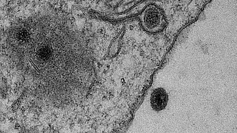 Yaravirus: Νέος μυστηριώδης ιός προβληματίζει τους επιστήμονες