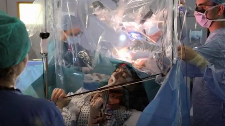 Απίστευτο βίντεο: Ασθενής παίζει βιολί την ώρα επέμβασης στον εγκέφαλο
