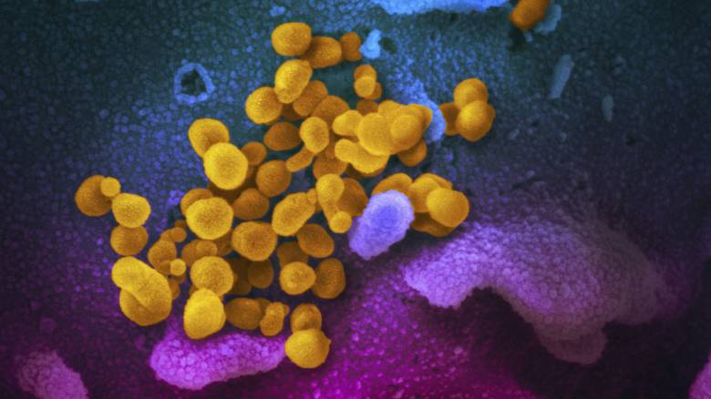 Κοροναϊός: Πόσο διάστημα μπορεί να επιβιώσει ο ιός πάνω σε επιφάνειες;