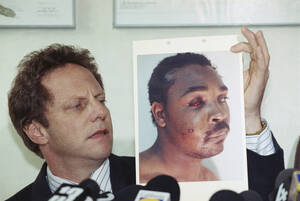 1991
Ο δικηγόρος του Ρόντνεϊ Κινγκ παρουσιάζει σε συνέντευξη Τύπου μια φωτογραφία του πελάτη του, ο οποίος ξυλοκοπήθηκε άγρια και εντελώς αναίτια από λευκούς αστυνομικούς μετά από μια τροχαία παράβαση. η δίκη του Κινγκ έγινε σύμβολο ενάντια στην αστυνομι