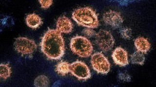 Νέα μελέτη: Πολύ πιο ανθεκτικός στο δέρμα σε σχέση με τη γρίπη ο νέος κορωνοϊός