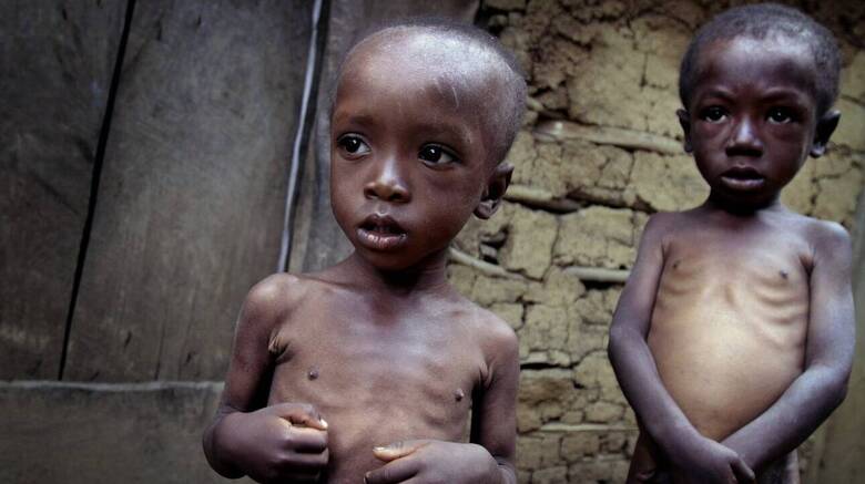 ΟΗΕ - Κορωνοϊός: Ενδέχεται να πεθάνουν από υποσιτισμό επιπλέον 10.000 παιδιά