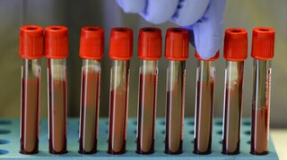 Εξέταση αίματος που μπορεί να εντοπίσει 50 τύπους καρκίνου ξεκινά να δοκιμάζει η Μεγάλη Βρετανία