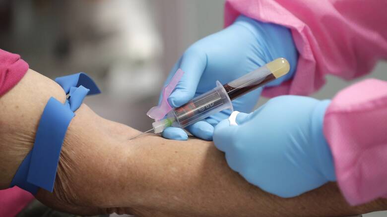 Πρέπει να κάνουμε τεστ αντισωμάτων μετά τον εμβολιασμό;