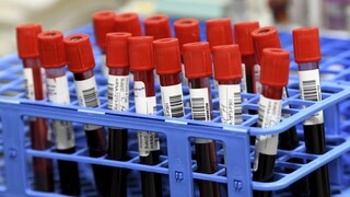 Κορωνοϊός: Για τουλάχιστον οκτώ μήνες μετά τη μόλυνση παραμένουν αντισώματα στο αίμα