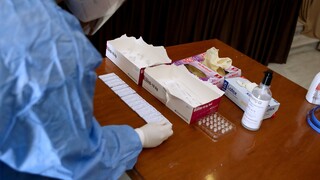 Μετάλλαξη Μποτσουάνα: Επανέλεγχος σε όλα τα θετικά PCR τεστ των τελευταίων 15 ημερών