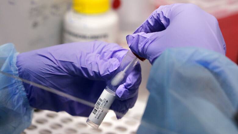 Κορωνοϊος-Γερμανία: Πλήρως εμβολιασμένοι βρέθηκαν θετικοί στη μετάλλαξη Όμικρον
