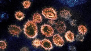 «Πονοκέφαλος» η μετάλλαξη Όμικρον για τους επιστήμονες: Τα τρία σενάρια για τον ιό «μυστήριο»