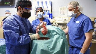 Επιτυχημένη η πρώτη στον κόσμο μεταμόσχευση καρδιάς από γενετικά τροποποιημένο χοίρο σε άνθρωπο