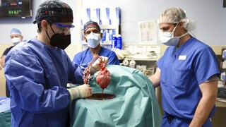 ΗΠΑ: Πέθανε ο πρώτος ασθενής με μεταμόσχευση καρδιάς από γενετικά τροποποιημένο χοίρο