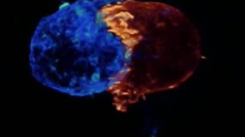 Σε βίντεο η μάχη που δίνει ένα Τ-λεμφοκύτταρο για να σκοτώσει ένα καρκινικό κύτταρο
