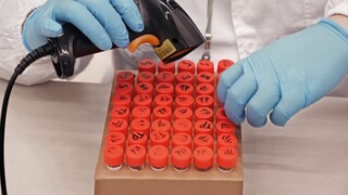 Κορωνοϊός: Επιστήμονες δημιούργησαν τεστ ούρων που ανιχνεύει τα αντισώματα
