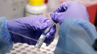 Κορωνοϊός: Επιστήμονες εκτιμούν πως ο ιός μπορεί να «ξεγλιστρήσει» από το Paxlovid της Pfizer