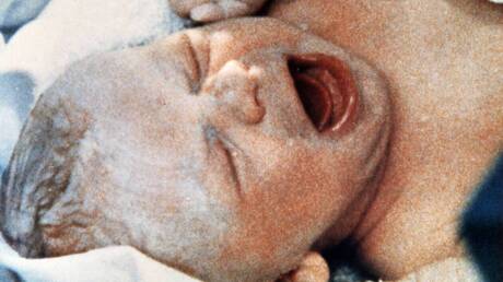 Σαν σήμερα: Η 25η Ιουλίου στην Ιστορία - Που βρίσκεται σήμερα το πρώτο μωρό «του σωλήνα»;