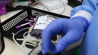 Ιστορική απόφαση του FDA: Εγκρίθηκε στις ΗΠΑ η πρώτη γονιδιακή θεραπεία για ασθενείς με θαλασσαιμία