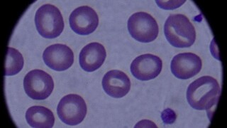Ιατρική «επανάσταση»: Δημιουργήθηκε αίμα σε εργαστήριο – Ξεκινούν κλινικές δοκιμές