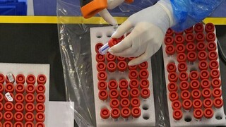 ΠΟΥ: Τα παγκόσμια αποθέματα εμβολίων χολέρας είναι «άδεια ή εξαιρετικά χαμηλά»