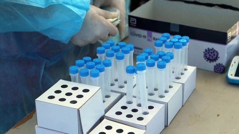 Κορωνοϊός: Διευκρινίσεις ΑΑΔE για τον ΦΠΑ 6% σε rapid test και PCR