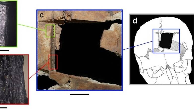 Ενδείξεις χειρουργικής εγκεφάλου πριν 3.500 χρόνια - Βρέθηκε κρανίο με τετραγωνισμένη τρύπα