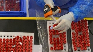 Έρευνα: Η παραλλαγή Όμικρον είναι πιο θανατηφόρα από την εποχική γρίπη