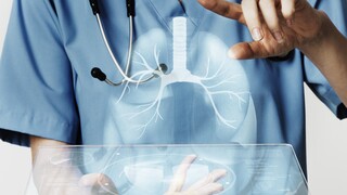 Καρκίνος του Πνεύμονα: Καμπάνια για την εξάλειψη του στίγματος στους ασθενείς