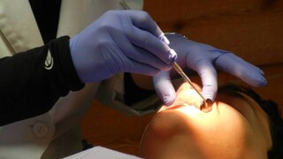 Οδοντίατροι για dentist pass: «Να επεκταθεί και σε άλλες ηλικίες»