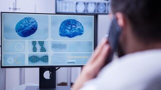 Alzheimer: Ο Όμιλος Affidea επενδύει στην Τεχνητή Νοημοσύνη για την διάγνωση της άνοιας